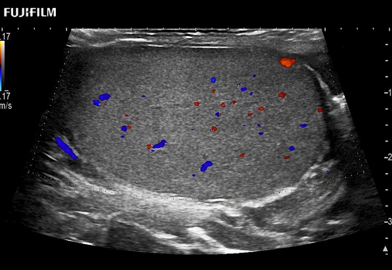 Testis ColorTrapezoid 10